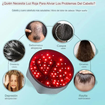 LumiGrow Pro Cap - Dispositivo de Crecimiento Capilar con Tecnología LED